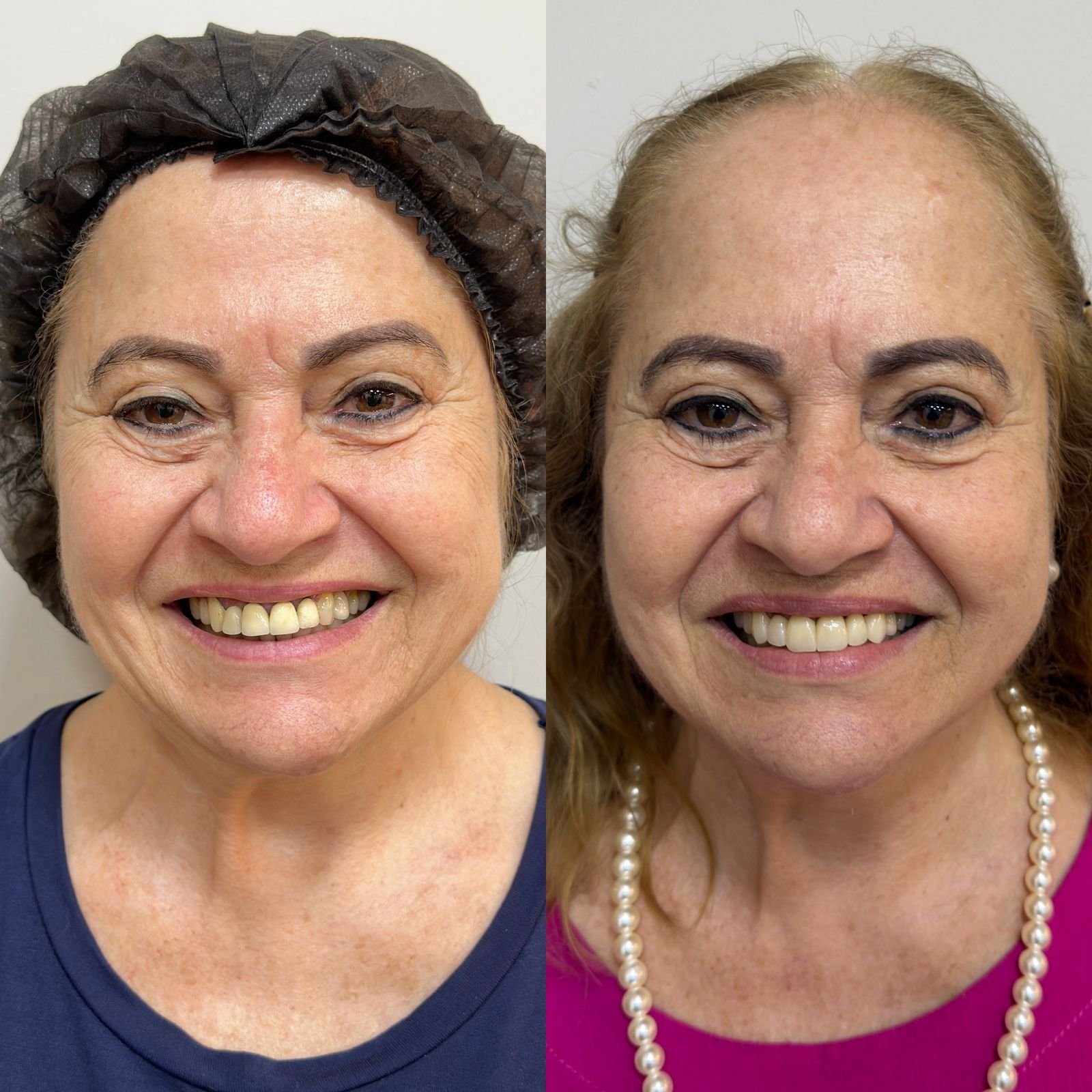 01 - ANTES E DEPOIS - 20.08
